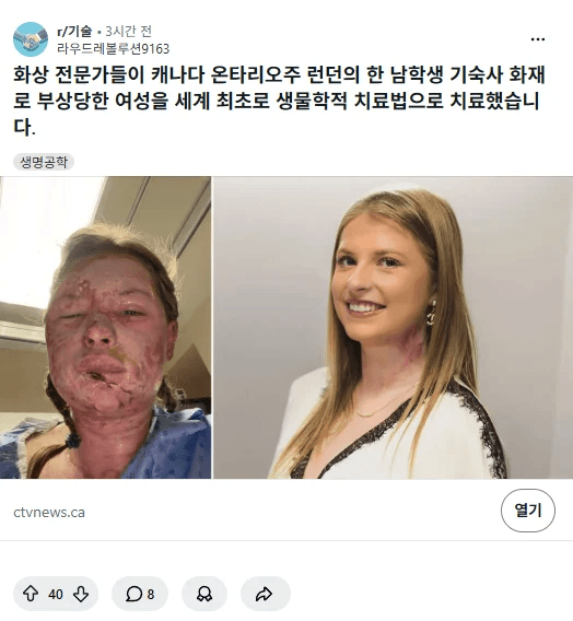 게시물 이미지