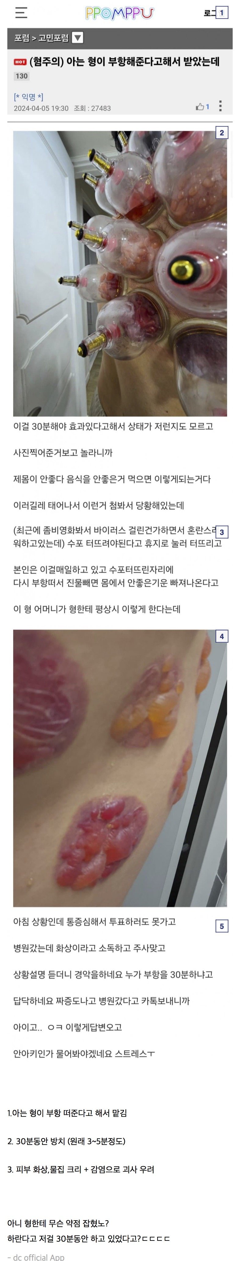 게시물 이미지